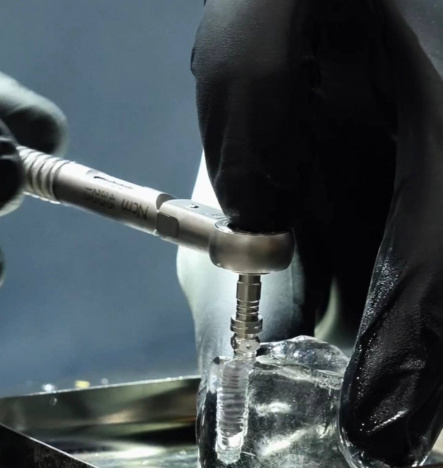 Операция по установке импланта «INNO» (Южная Корея)